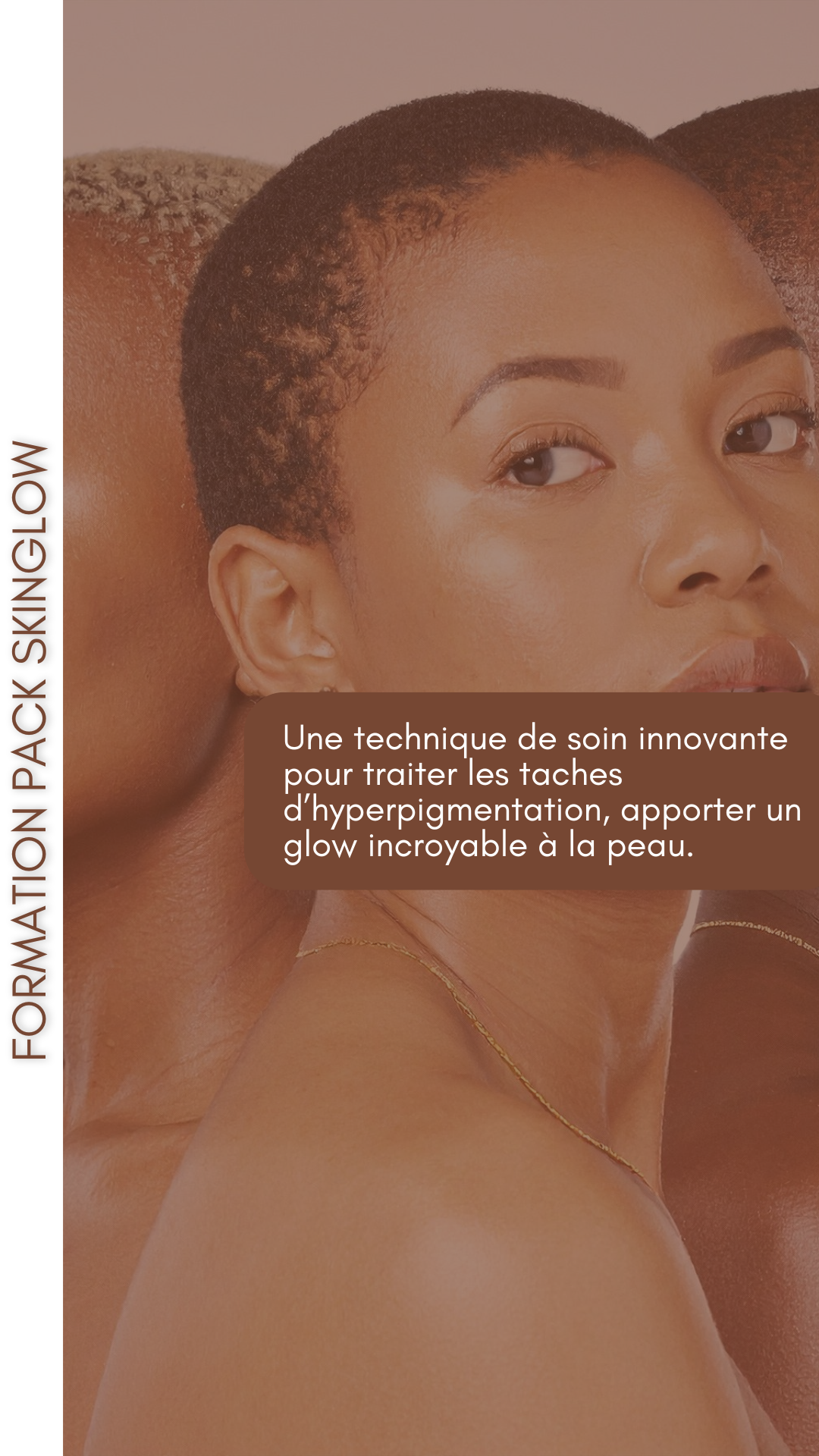 FORMATION PACK SKINGLOW