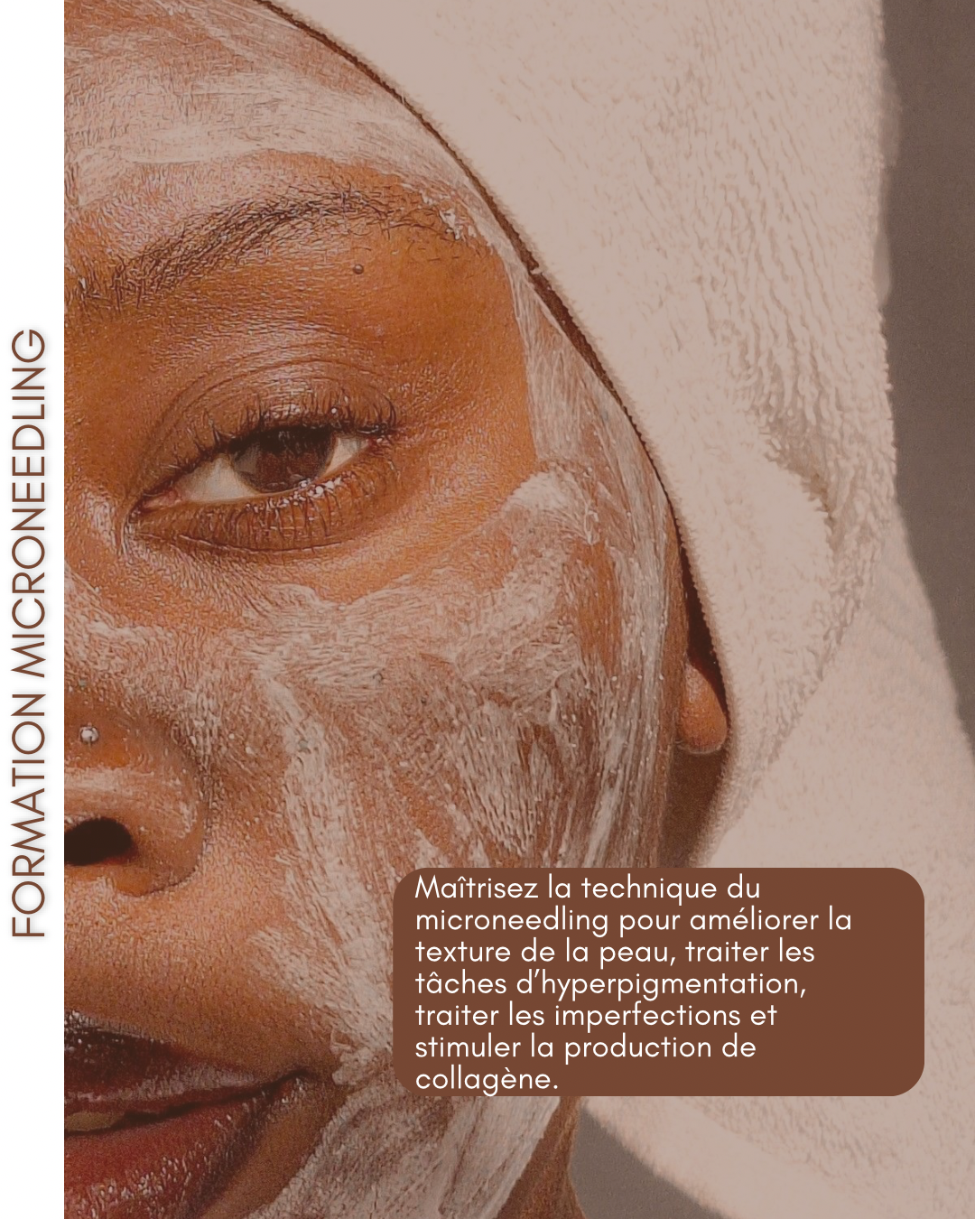 FORMATION MICRONEEDLING